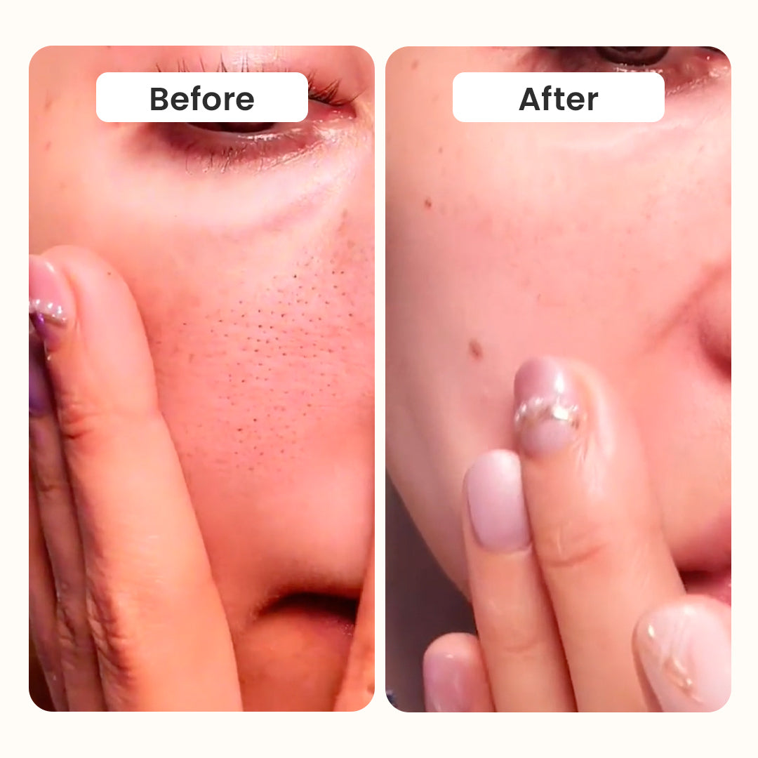 Exfoliating Rice Peel Serum Duo