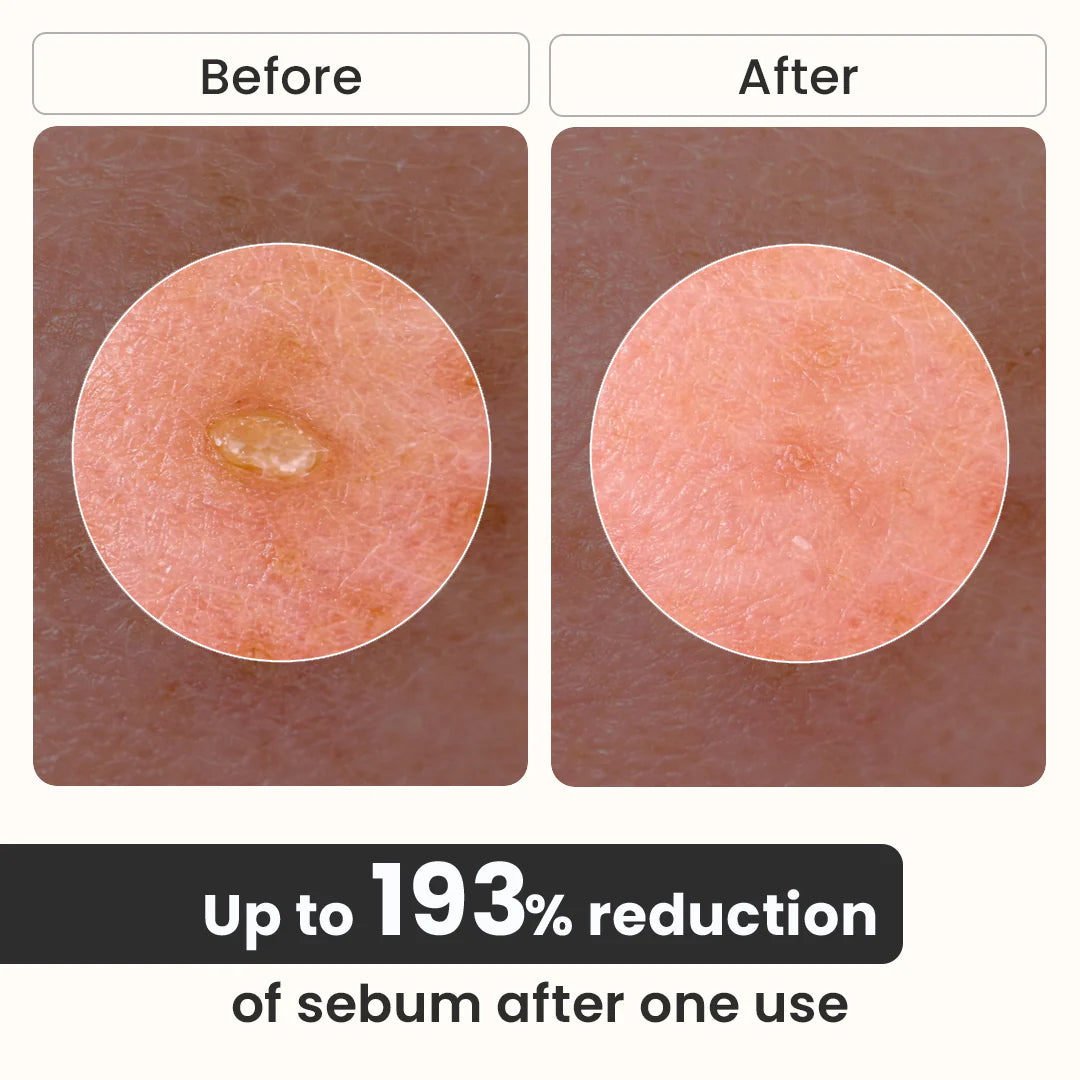 Exfoliating Rice Peel Serum Duo